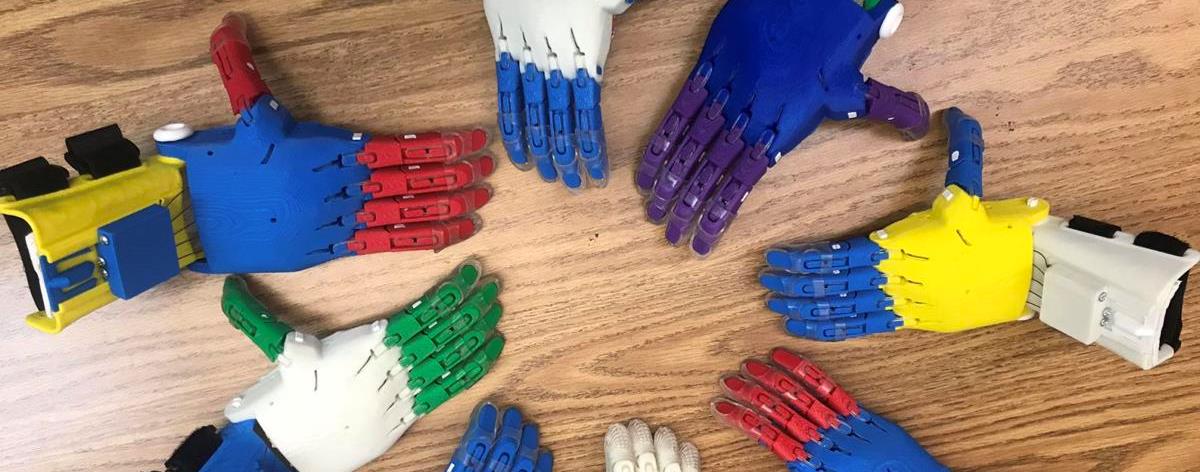 3D printed prosthetic hands